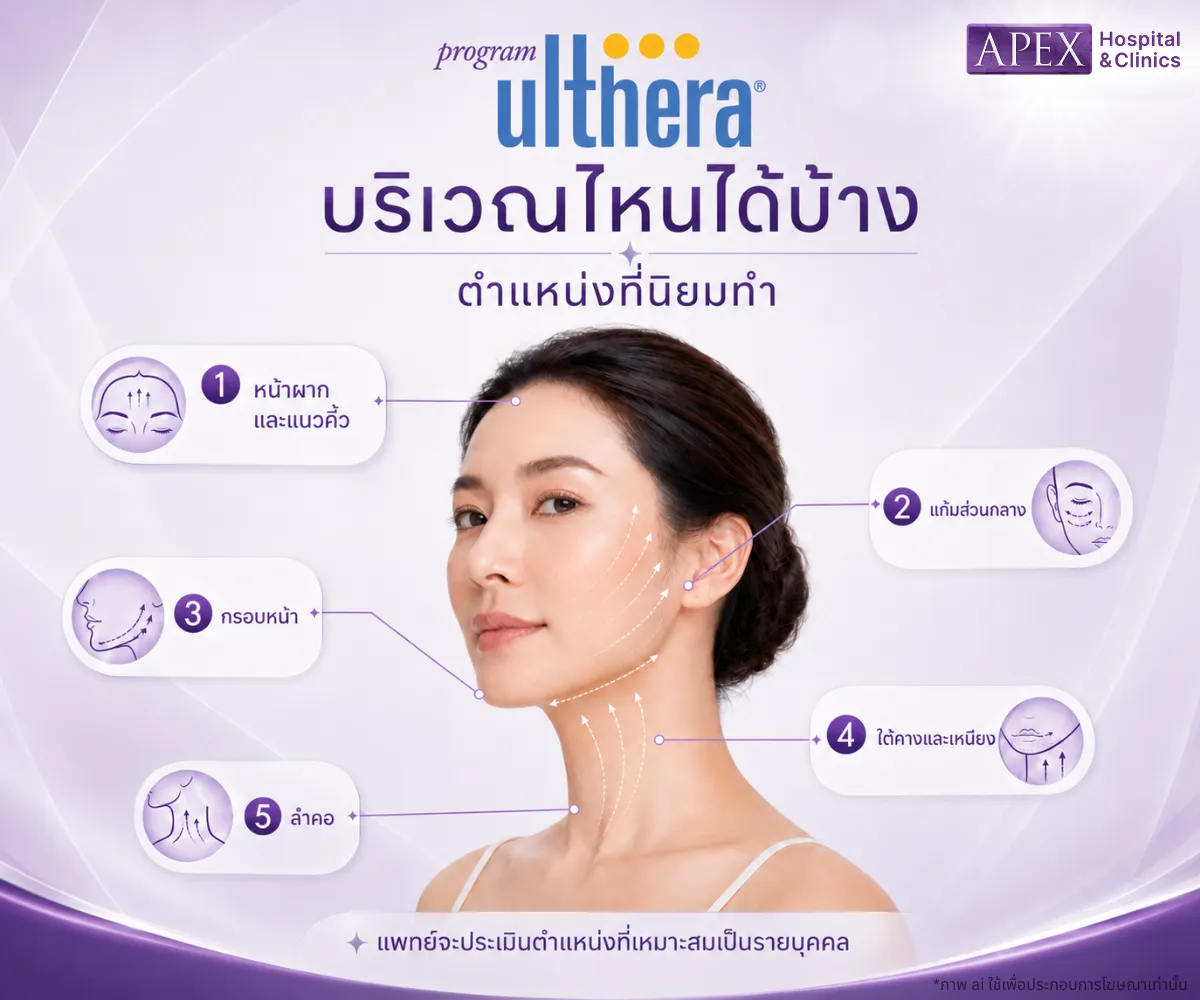 Ulthera เหมาะกับใคร แก้ปัญหากรอบหน้าไม่ชัด